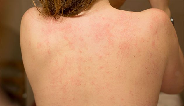 plaque en acrylique pour douche